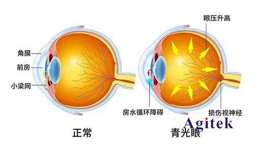 TH2851系列高精密阻抗分析儀在新型眼科中的應用(圖1)